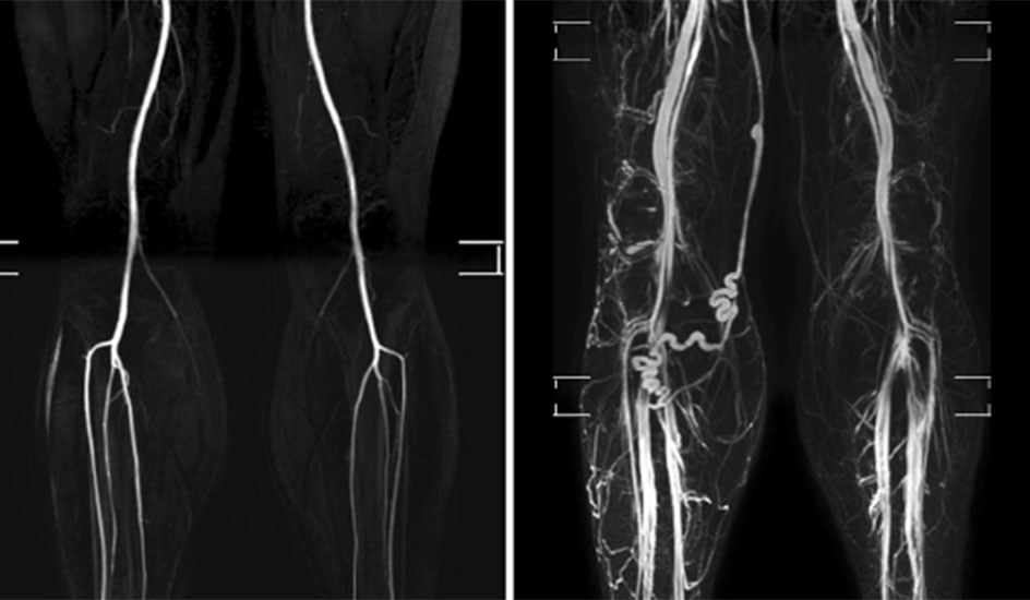 Whole-Body MRI